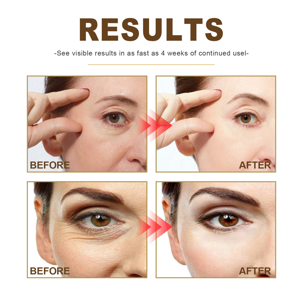 OUHOE Collagen Anti-Wrinkle Essence for Youthful Skin
